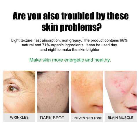 EELHOE Acne & Blemish Cream Lightens Blemishes & Acne Brightens Skin Complexion Moisturizing Skin Repair Cream